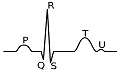 een schematische weergave van een hartfilmpje, met de letters P, Q, R, S, T en U bij de pieken